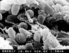 (Scanning electron micrograph depicting a mass of Yersinia pestis bacteria (the cause of bubonic plague) in the foregut of the flea vector Credit: Rocky Mountain Laboratories, NIAID, NIH http://www3.niaid.nih.gov/biodefense/Public/Images.htm)